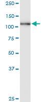 Anti-GTF3C2 Polyclonal Antibody Pair