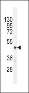 Anti-CMGA Rabbit Polyclonal Antibody (HRP (Horseradish Peroxidase))