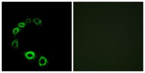 Immunofluorescence analysis of HeLa cells using Anti-GPR175 Antibody. The right hand panel represents a negative control, where the Antibody was pre-incubated with the immunising peptide