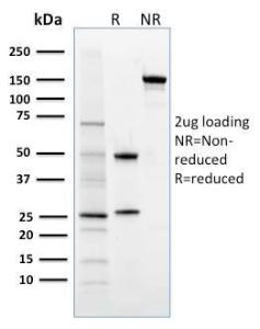 SDS-PAGE analysis of Anti-FOXP3 Antibody [3G3] under non-reduced and reduced conditions; showing intact IgG and intact heavy and light chains, respectively. SDS-PAGE analysis confirms the integrity and purity of the antibody.