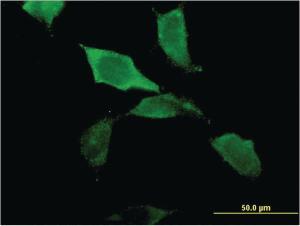 Anti-ZBP1 Mouse Monoclonal Antibody [clone: 2C10]