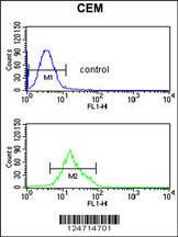 Anti-TCHP Rabbit Polyclonal Antibody