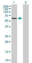 Anti-ENO2 Rabbit Polyclonal Antibody