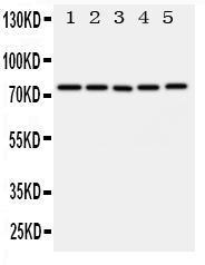 Anti-ABCG1 Rabbit Polyclonal Antibody