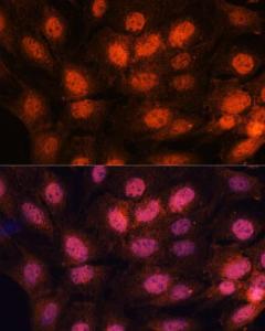 Immunofluorescence analysis of C6 cells using Anti-CTF18 Antibody (A306138) at a dilution of 1:100. DAPI was used to stain the cell nuclei (blue)