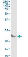 Anti-AK1 Antibody Pair