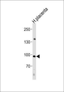 Anti-NFATC4 Rabbit Polyclonal Antibody (AP (Alkaline Phosphatase))