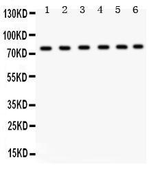 Anti-TRPV5 Rabbit Polyclonal Antibody