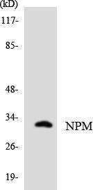 Western blot analysis of the lysates from HT 29 cells using Anti-NPM Antibody