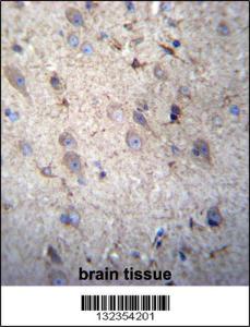 Anti-GSTM5 Rabbit Polyclonal Antibody (PE (Phycoerythrin))