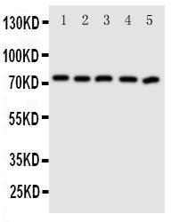 Anti-ABCG5 Rabbit Polyclonal Antibody