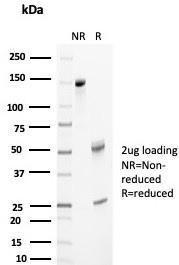 SDS-PAGE analysis of Anti-Clusterin Antibody [CLU/4733] under non-reduced and reduced conditions; showing intact IgG and intact heavy and light chains, respectively. SDS-PAGE analysis confirms the integrity and purity of the antibody.