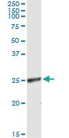 Anti-RNF114 Antibody Pair