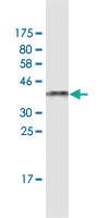 Anti-MIEN1 Mouse Monoclonal Antibody [clone: 3B5]