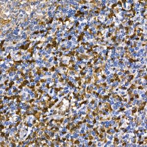 Anti-Annexin A1/ANXA1 antibody