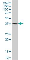 Anti-TMOD4 Mouse Polyclonal Antibody