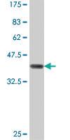 Anti-UROD Mouse Polyclonal Antibody