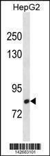 Anti-CMIP Rabbit Polyclonal Antibody (FITC (Fluorescein Isothiocyanate))