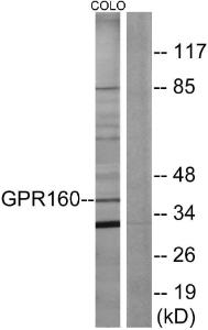 Anti-GPR160 antibody