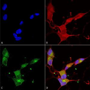 Immunocytochemistry/Immunofluorescence analysis of human neuroblastoma cells (SH-SY5Y), fixed in 4% PFA for 15 min, using Anti-KCNQ4 Antibody [N43/6] (A305021), at 1:100 for overnight at 4°C with slow rocking