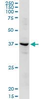 Anti-ADH1C Rabbit Polyclonal Antibody