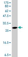 Anti-TDO2 Mouse Polyclonal Antibody