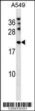 Anti-MPHOSPH6 Rabbit Polyclonal Antibody (HRP (Horseradish Peroxidase))