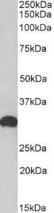 Antibody anti-POU6F1 100 µg