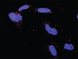 Anti-EPAS1 + SMAD3 Antibody Pair