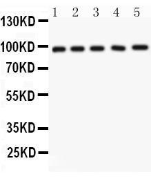 Anti-NUP98 Polyclonal Antibody