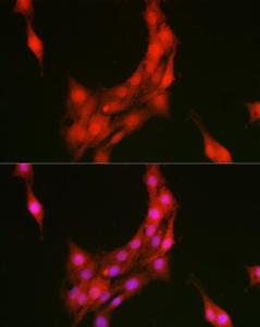 Anti-Annexin A1/ANXA1 antibody