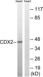 Western blot analysis of lysates from rat heart using Anti-CDX2 Antibody. The right hand lane represents a negative control, where the antibody is blocked by the immunising peptide.