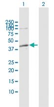 Anti-ADH1C Rabbit Polyclonal Antibody