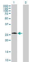 Anti-PSPH Mouse Polyclonal Antibody