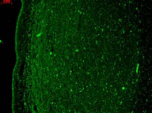 Immunohistochemistry analysis of human hippocampus, fixed in Bouin's fixative solution and paraffin-embedded The Primary Antibody used was Anti-KCNQ4 Antibody [N43/6] (A305021) at 1:1,000 for 1 hour at room temperature