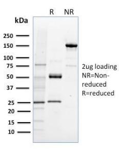 SDS-PAGE analysis of Anti-NRF1 Antibody [NRF1/2608] under non-reduced and reduced conditions; showing intact IgG and intact heavy and light chains, respectively. SDS-PAGE analysis confirms the integrity and purity of the antibody