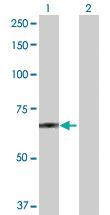 Anti-POGK Rabbit Polyclonal Antibody