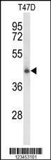 Anti-CLN5 Rabbit Polyclonal Antibody (FITC (Fluorescein))