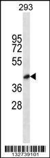 Anti-BVES Rabbit Polyclonal Antibody (FITC (Fluorescein Isothiocyanate))