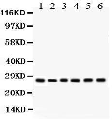 Anti-APRIL Rabbit Polyclonal Antibody