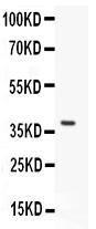 Anti-P2RX4/P2X4 Polyclonal Antibody