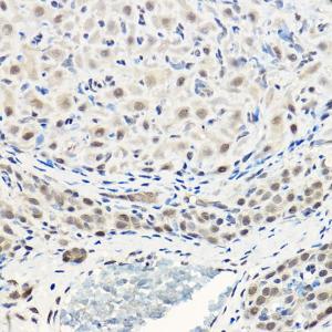 Immunohistochemistry analysis of paraffin-embedded rat ovary using Anti-AKT1 + AKT2 + AKT3 Antibody (A306139) at a dilution of 1:100 (40X lens). Perform high pressure antigen retrieval with 10 mM citrate buffer pH 6.0 before commencing with IHC staining protocol