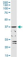 Anti-ADH1C Rabbit Polyclonal Antibody