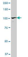 Anti-PDCD6IP Mouse Polyclonal Antibody