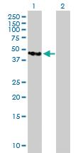 Anti-TMOD4 Mouse Polyclonal Antibody