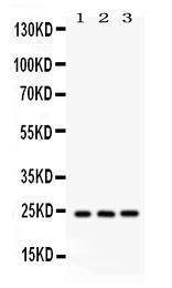 Anti-BAG2 Rabbit Polyclonal Antibody