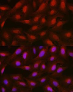 Anti-Annexin A1/ANXA1 antibody