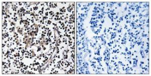 Immunohistochemical analysis of paraffin-embedded human lymph node tissue using Anti-SLC30A4 Antibody. The right hand panel represents a negative control, where the antibody was pre-incubated with the immunising peptide.