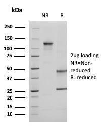 SDS-PAGE analysis of Anti-Ezrin Antibody [CPTC-Ezrin-1] under non-reduced and reduced conditions; showing intact IgG and intact heavy and light chains, respectively. SDS-PAGE analysis confirms the integrity and purity of the Antibody