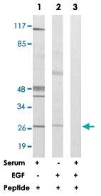 Anti-HOXD12 Rabbit Polyclonal Antibody